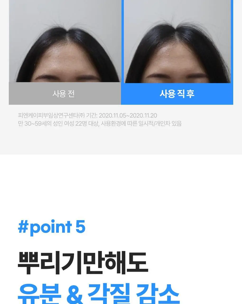 [지현우 PICK] 메디올 탈모케어 뉴트리션 에센스 120ml 상세페이지 17